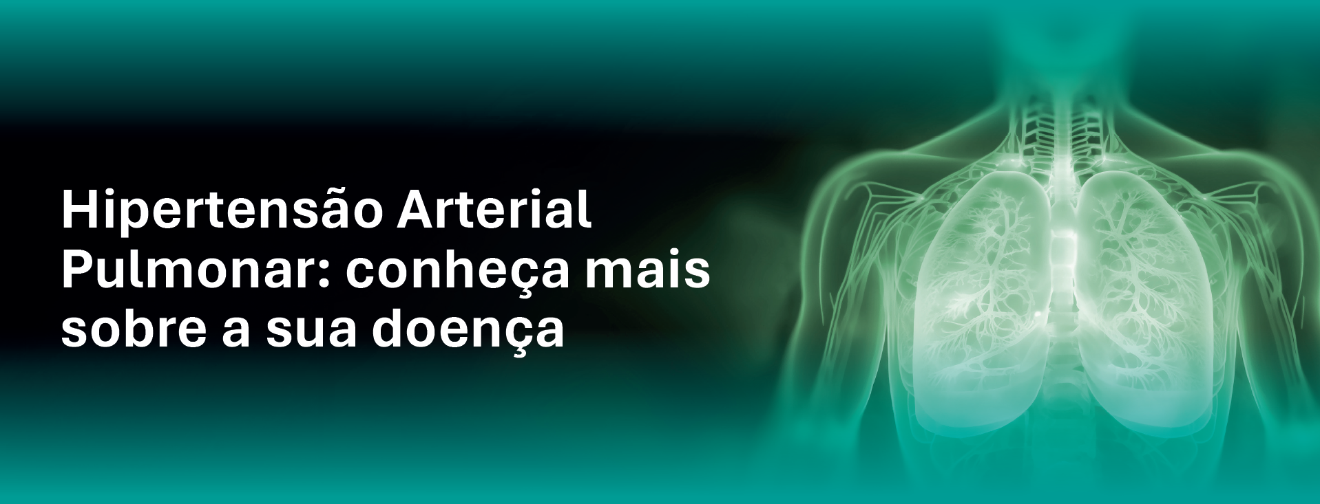 Hipertensão Arterial Pulmonar: conheça mais sobre a sua doença